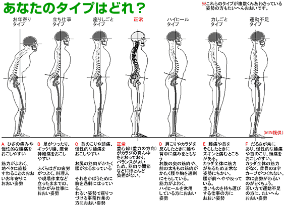 あなたのタイプはどれ?